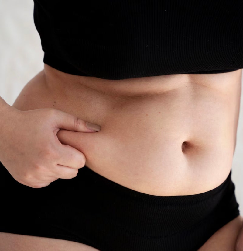 급하게 찐 살, 온다리프팅으로 얼굴 뿐만 아니라 바디라인까지 한번에 관리 사진 13