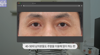 10살 늙어보이는 눈밑지방, 1시간만에 말끔히 해결됩니다 사진 4