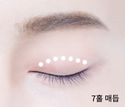 수능 끝! 강남역 자연유착 357펌라인으로 나에게 어울리는 쌍꺼풀 만들기, 대학생 새내기 첫 성형 사진 5