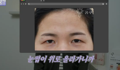 윗집 아줌마 쌍꺼풀 망했다며? 중년쌍꺼풀은 따로 있는데 아가씨들 하는걸 했대.. 사진 19