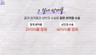 윗집 아줌마 쌍꺼풀 망했다며? 중년쌍꺼풀은 따로 있는데 아가씨들 하는걸 했대.. 사진 25