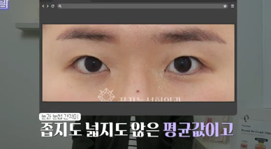 윗집 아줌마 쌍꺼풀 망했다며? 중년쌍꺼풀은 따로 있는데 아가씨들 하는걸 했대.. 사진 26