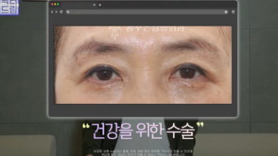 중년성형 필독! 망하는 병원 고르는 치명적 실수 3가지 사진 14