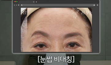 중년성형 필독! 망하는 병원 고르는 치명적 실수 3가지 사진 15