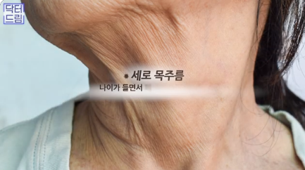 얼굴만 팽팽? 여길 보면 관리 잘 하는지 티나는거 원탑, 목주름 사진 5