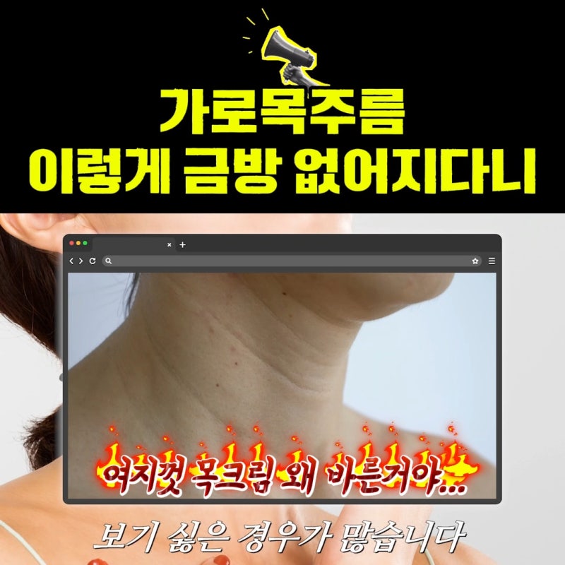 얼굴만 팽팽? 여길 보면 관리 잘 하는지 티나는거 원탑, 목주름