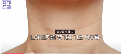 얼굴만 팽팽? 여길 보면 관리 잘 하는지 티나는거 원탑, 목주름 사진 4
