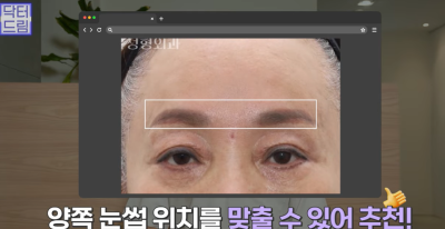 미인대회 출신 사부인 가볍게 밟아버린 중년동안수술 사진 23