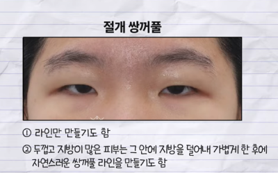 미인대회 출신 사부인 가볍게 밟아버린 중년동안수술 사진 5