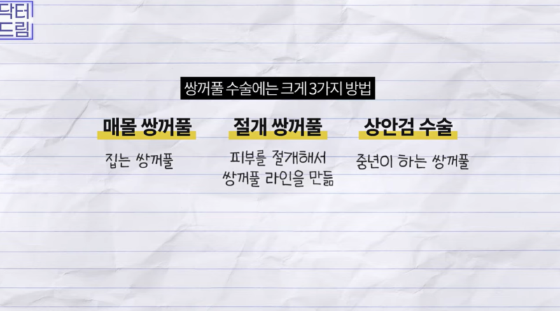 미인대회 출신 사부인 가볍게 밟아버린 중년동안수술