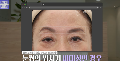 미인대회 출신 사부인 가볍게 밟아버린 중년동안수술 사진 24