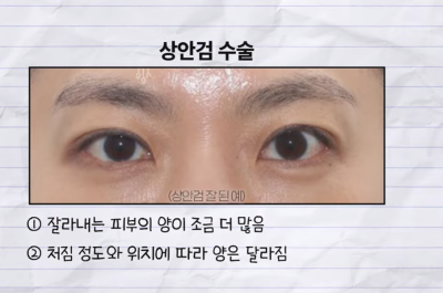 미인대회 출신 사부인 가볍게 밟아버린 중년동안수술 사진 8