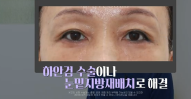 이번 명절 선물은 며느리 몰래 젊어지는 중년성형으로 하세요 사진 11