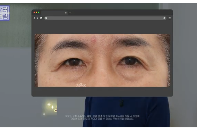이번 명절 선물은 며느리 몰래 젊어지는 중년성형으로 하세요 사진 13