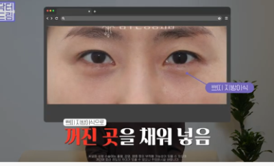 더 새로워지고 더 강력해진, 꼭 알아야하는 2026 중년성형트렌드 사진 5