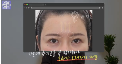 더 새로워지고 더 강력해진, 꼭 알아야하는 2026 중년성형트렌드 사진 18