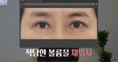 더 새로워지고 더 강력해진, 꼭 알아야하는 2026 중년성형트렌드 사진 11