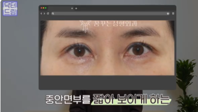 더 새로워지고 더 강력해진, 꼭 알아야하는 2026 중년성형트렌드 사진 10