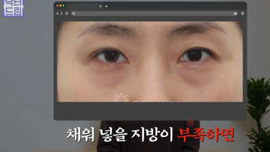 더 새로워지고 더 강력해진, 꼭 알아야하는 2026 중년성형트렌드 사진 4