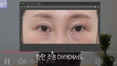 더 새로워지고 더 강력해진, 꼭 알아야하는 2026 중년성형트렌드
