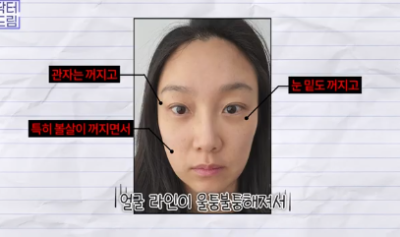 이거 안하면 확늙더라구요. 성형외과원장 부인이 꼭 하는 가성비갑 최애시술 TOP3 사진 27