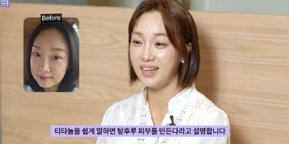 이거 안하면 확늙더라구요. 성형외과원장 부인이 꼭 하는 가성비갑 최애시술 TOP3 사진 10