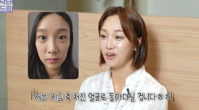 이거 안하면 확늙더라구요. 성형외과원장 부인이 꼭 하는 가성비갑 최애시술 TOP3 사진 17