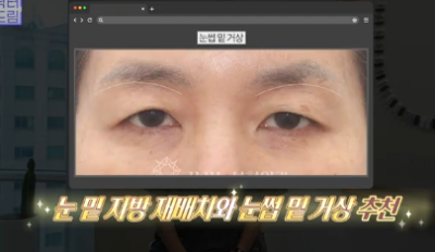 이번 연휴, 남들 쉴 때 예뻐질 결심! 기간별 성형족보총정리(feat.어버이날 선물) 사진 10
