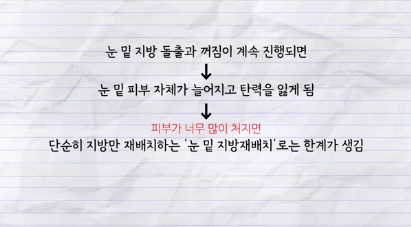 유형별로 다른 눈밑지방재배치 핵심가이드, 실패하는 이유 알고 가세요 사진 14