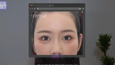중년쌍꺼풀, 상안검 하면 안되는 눈이 있습니다! 사진 9
