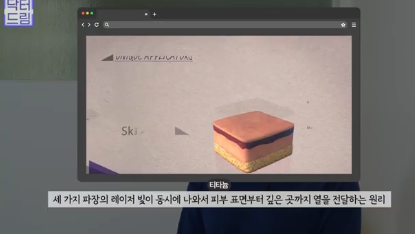 실제로 해보니 정말 효과있었던 탄력레이저는 이겁니다(울쎄라,텐써마,티타늄,온다,포텐자) 사진 12