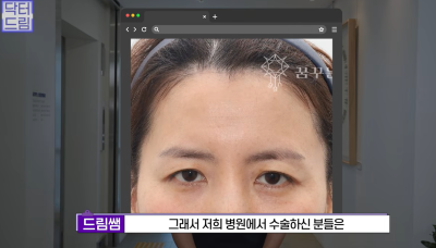 눈 성형 후 사나워진 얼굴, 딱 1가지가 똑같습니다 사진 25