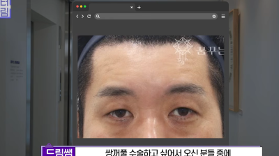 눈 성형 후 사나워진 얼굴, 딱 1가지가 똑같습니다 사진 15