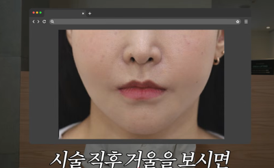 효과는 즉시! 유지기간은 2배 늘리는 숨겨진 시술 비밀 사진 13