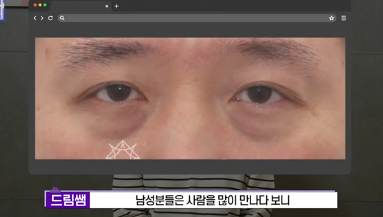전현무도 한 중년수술, 이게 현실입니다 사진 11