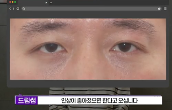 전현무도 한 중년수술, 이게 현실입니다 사진 12