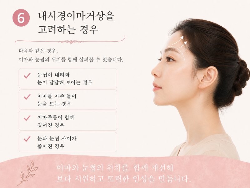 요새 누가 티 나게 성형해요? 자연스러운 성형 추천, 강남역 꿈꾸는성형외과 사진 9