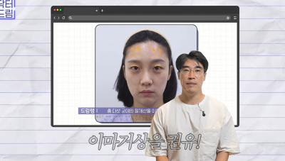 1000명 상안검수술 해준 의사가 아내는 안해준 이유 사진 14