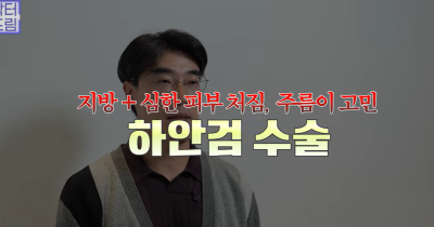눈밑지vs하안검, 연예인A씨가 이걸 몰라서 잘못됐습니다 사진 31